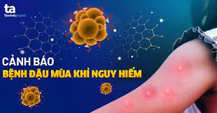 Chủ động phòng chống bệnh đậu mùa khỉ